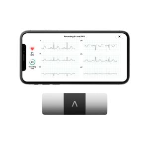 AliveCor KardiaMobile 6L | Le Moniteur ECG Personnel connecté à 6 dérivations. Détectez la Fibrillation auriculaire en Seulement 30 Secondes - ...