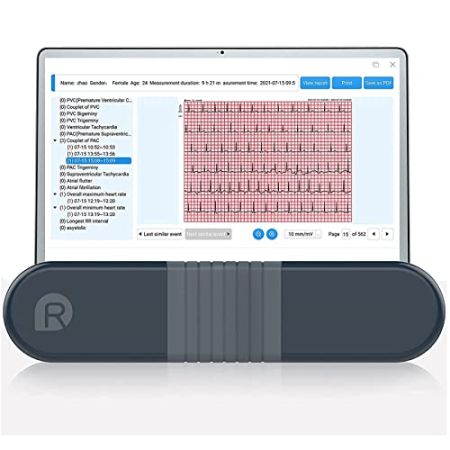 Wellue Moniteur ECG, Enregistreur Holter Professionnel avec Rapport d'Analyse AI-ECG, Enregistrement Holter ECG 24 Heures, Logiciel PC de Support, ...