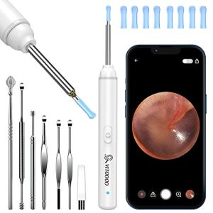 VITCOCO Otoscope Oreille 1920P 3mm HD Earigator avec 6 Lumières LED Outil de Nettoyage d'oreille Adapté aux Smartphones iOS et Android(Blanc)