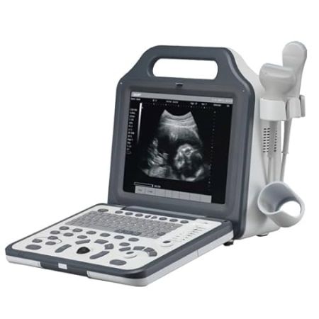 Portable Black and White Digital Ultrasound, Model N5